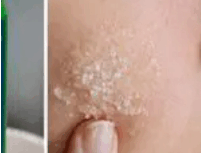 Epsom salt can be used to treat nine common health issues