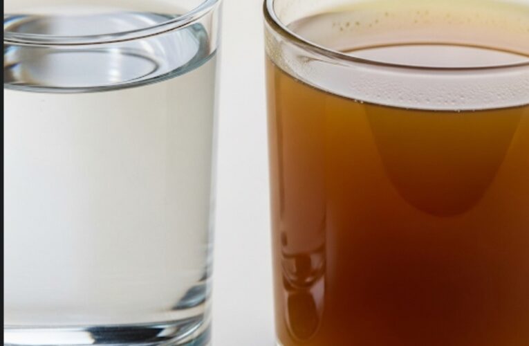 If Your Urine Smells Strong or Foamy — Don’t Ignore It, Here’s What Your Body Is Saying